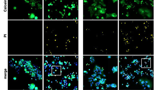 New Publication | SYNENTEC CELLAVISTA® and YT®-Software used for Cell Death Quantification and an Observation of the Formation of Fragmented Apoptotic Cells and Bodies